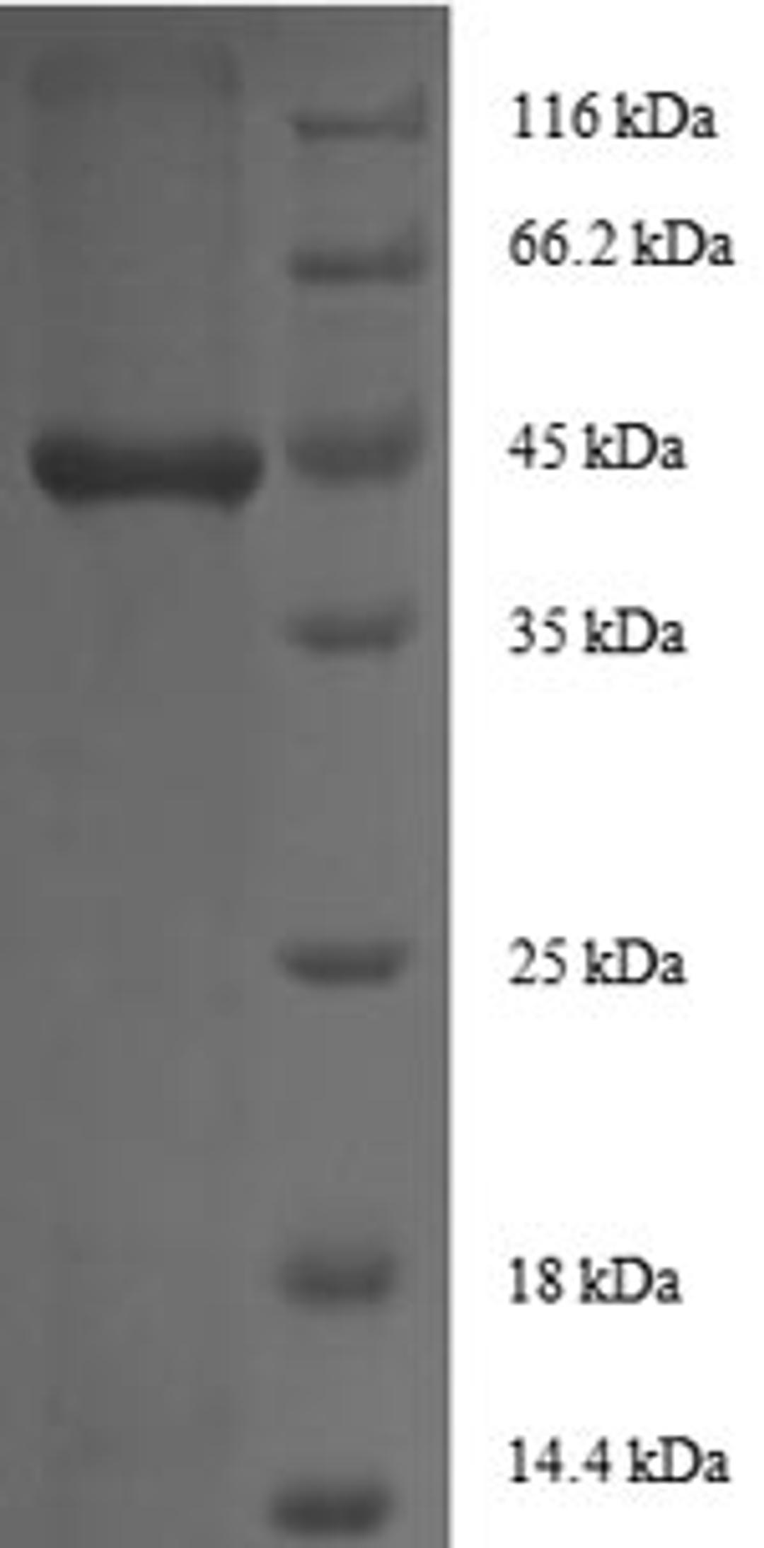 (Tris-Glycine gel) Discontinuous SDS-PAGE (reduced) with 5% enrichment gel and 15% separation gel.