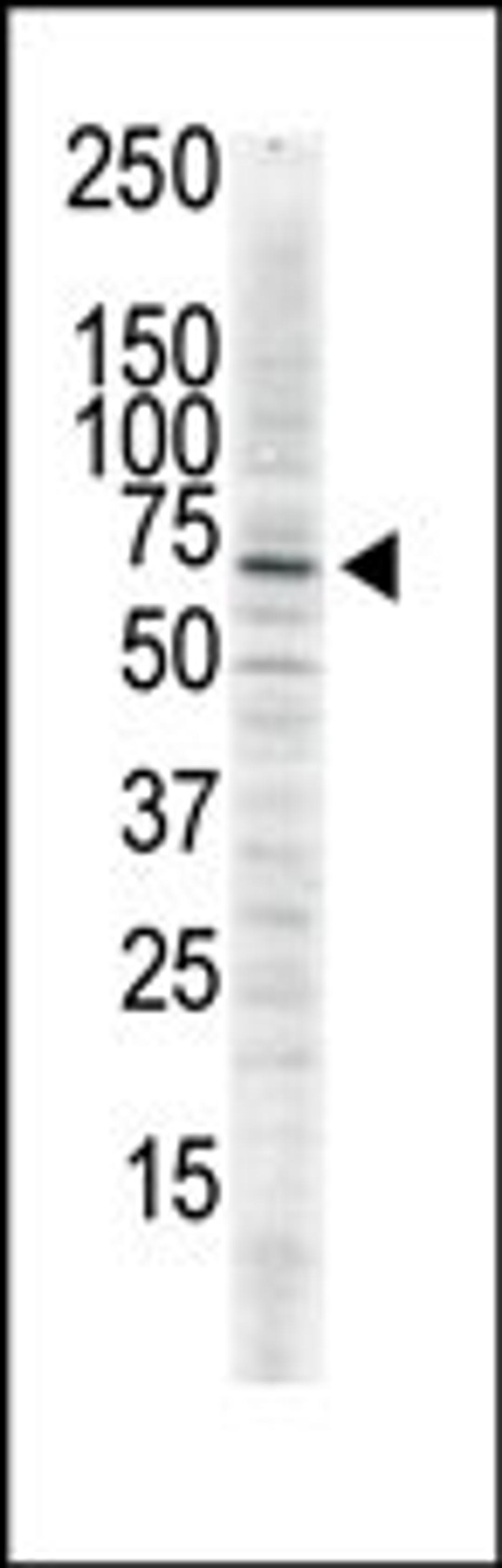 Antibody is used in Western blot to detect CAMK2 delta in serum-starved HeLa cell lysate.