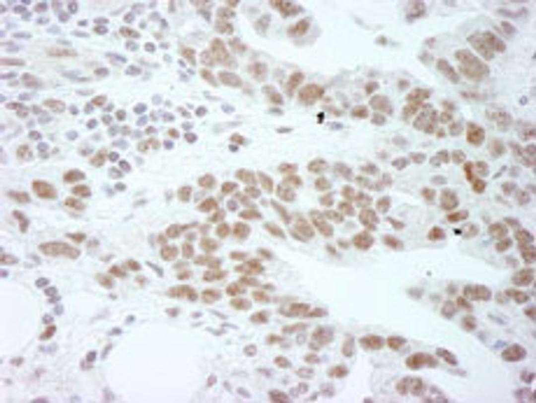 Detection of human DDX1 by immunohistochemistry.