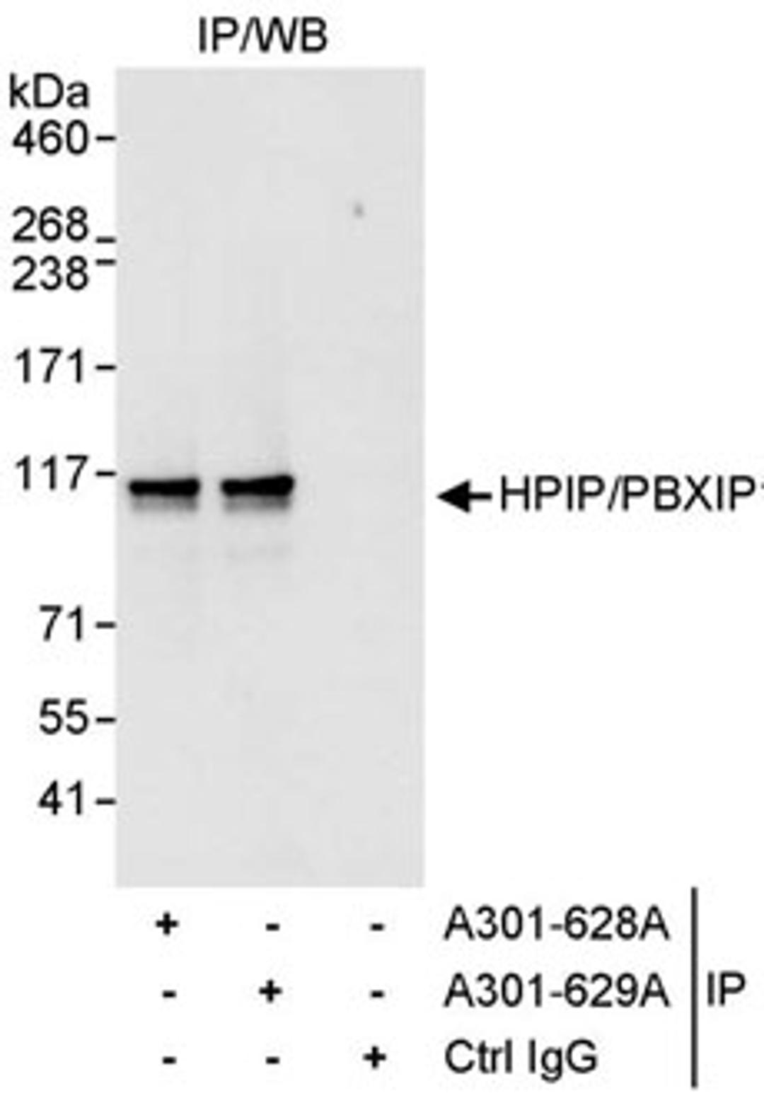 Detection of human HPIP/PBXIP1 by western blot of immunoprecipitates.