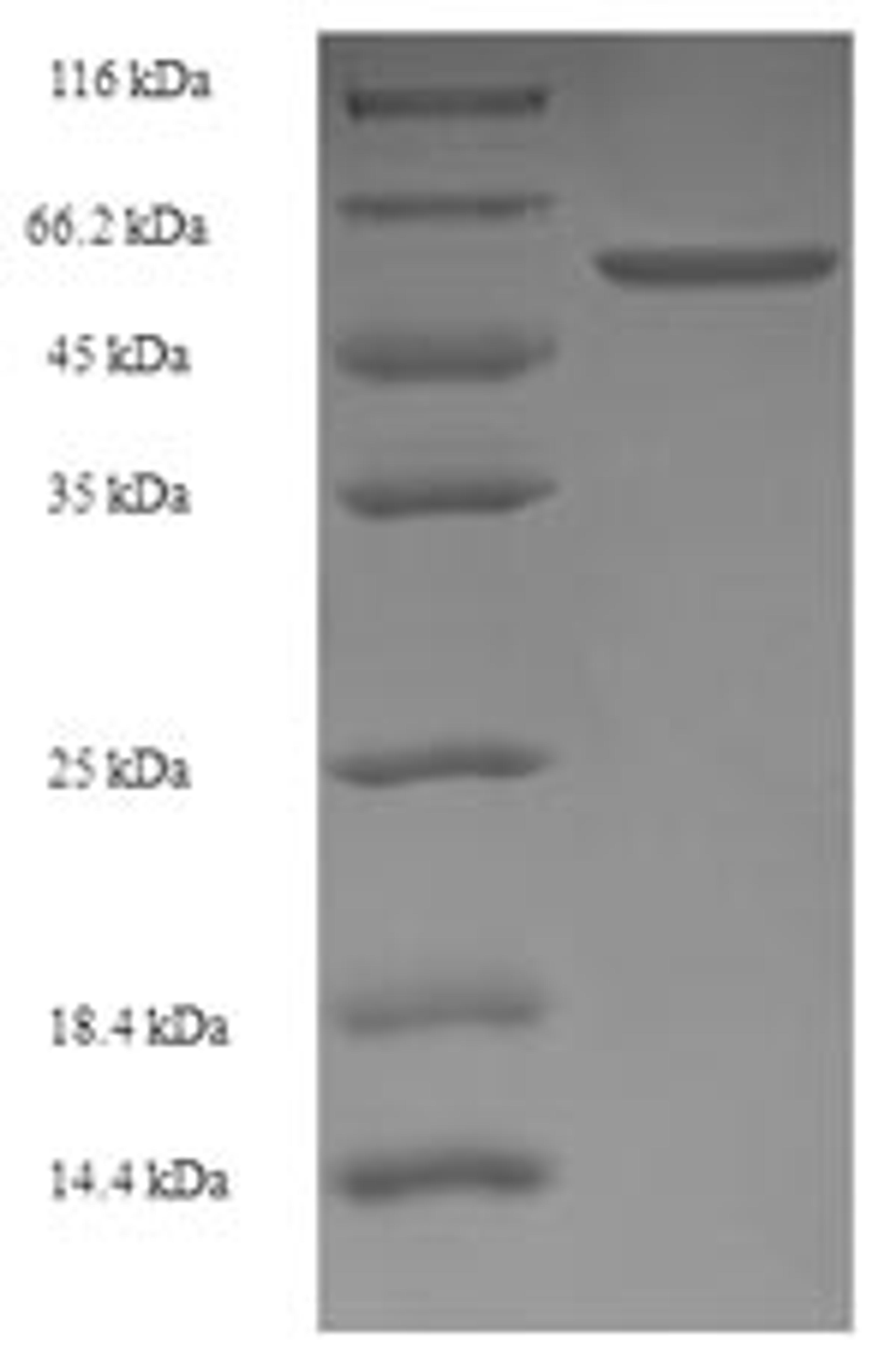 (Tris-Glycine gel) Discontinuous SDS-PAGE (reduced) with 5% enrichment gel and 15% separation gel.