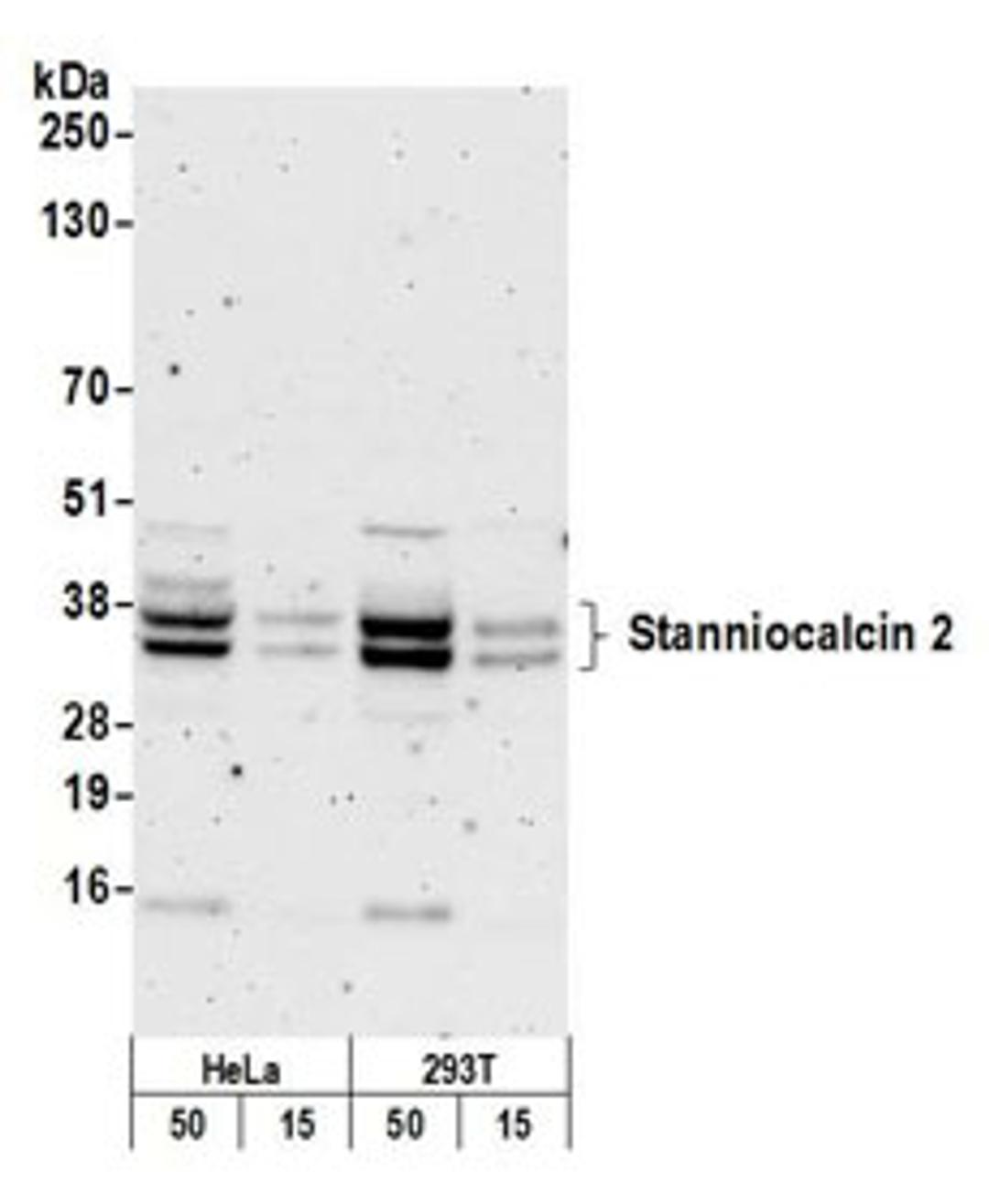 Detection of human Stanniocalcin 2 by western blot.