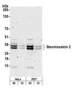 Detection of human Stanniocalcin 2 by western blot.