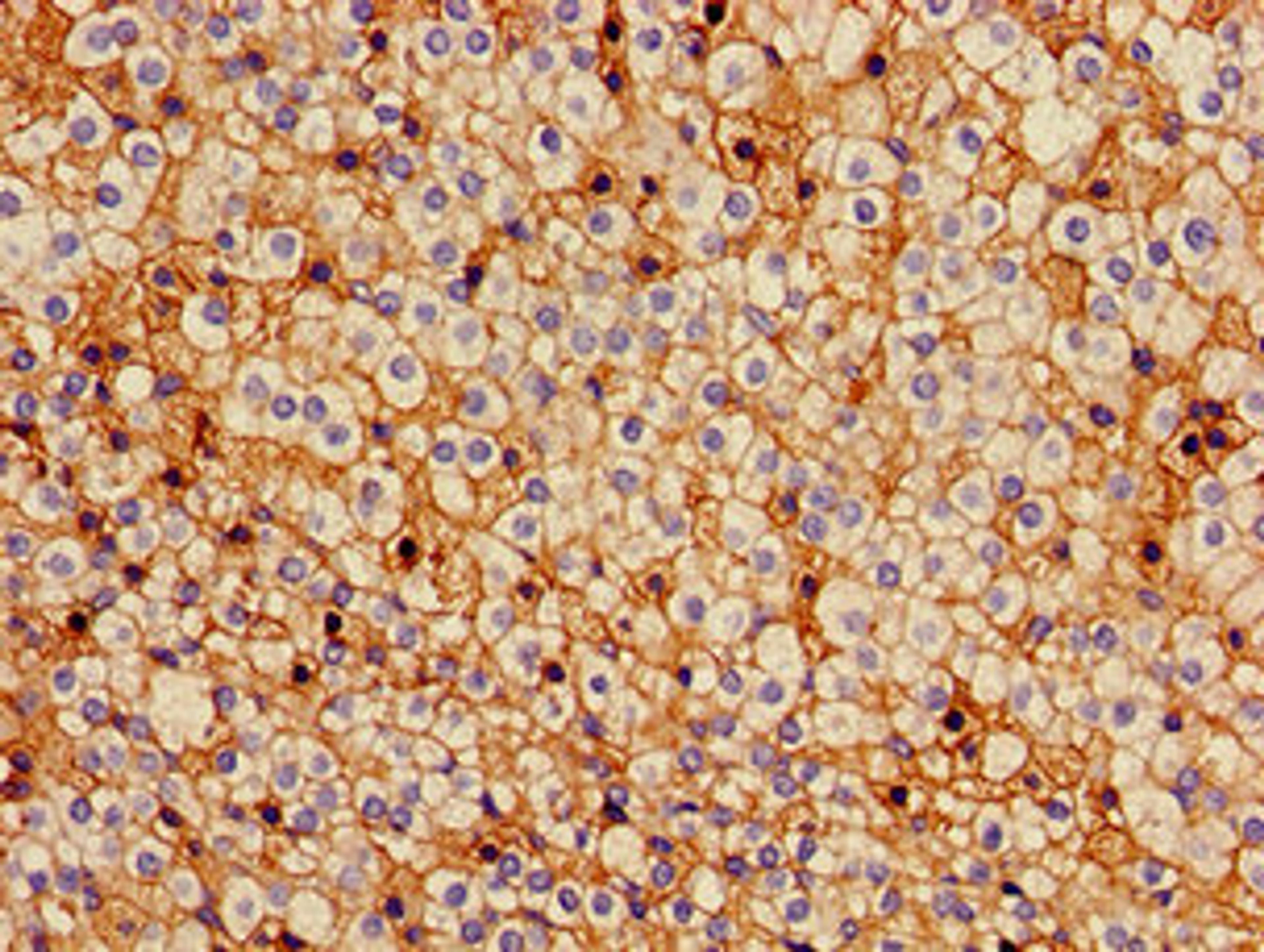 Immunohistochemistry of paraffin-embedded human adrenal gland tissue using CSB-PA009448LA01HU at dilution of 1:100