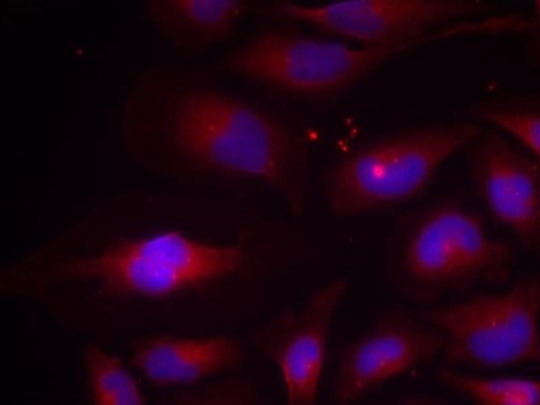 Immunocytochemistry/Immunofluorescence: NFkB p100/p52 [p Ser870] Antibody [NB100-82067] - Staining of methanol-fixed HeLa cells.