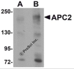 Western blot analysis of APC2 in HeLa cell lysate with APC2 antibody at (A) 1 and (B) 2 μg/mL.