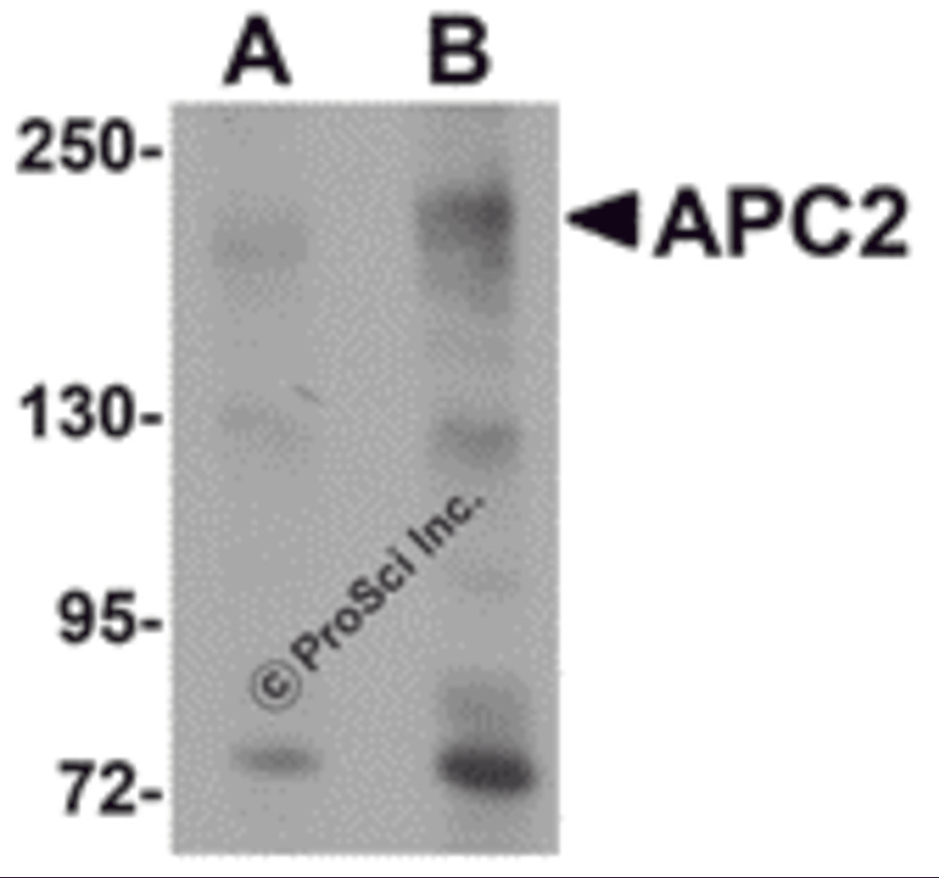 Western blot analysis of APC2 in HeLa cell lysate with APC2 antibody at (A) 1 and (B) 2 μg/mL.
