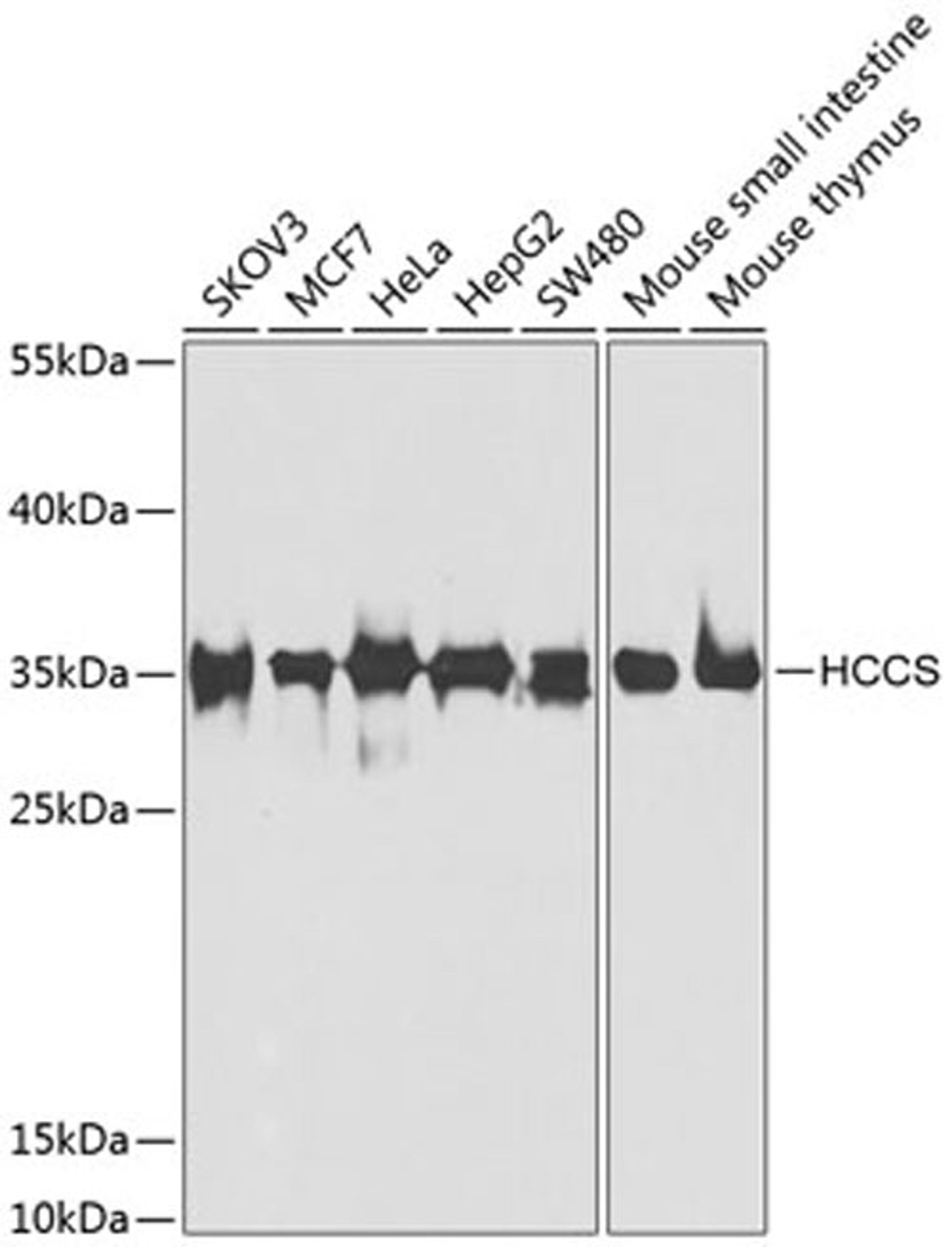 Western blot - HCCS antibody (A7490)