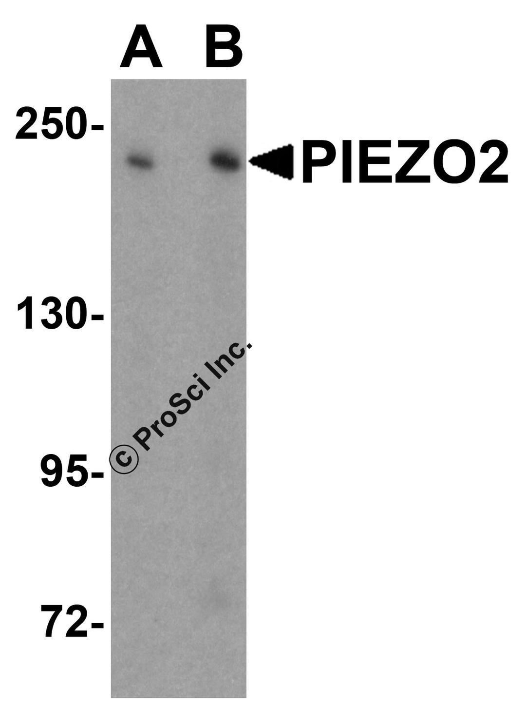 Western blot analysis of PIEZO2 in SK-N-SH cell lysate with PIEZO2 antibody at (A) 1 and (B) 2 &#956;g/mL.