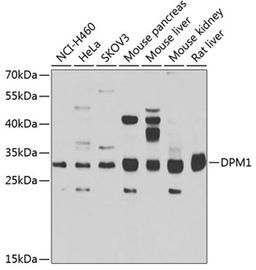 Western blot - DPM1 antibody (A7757)