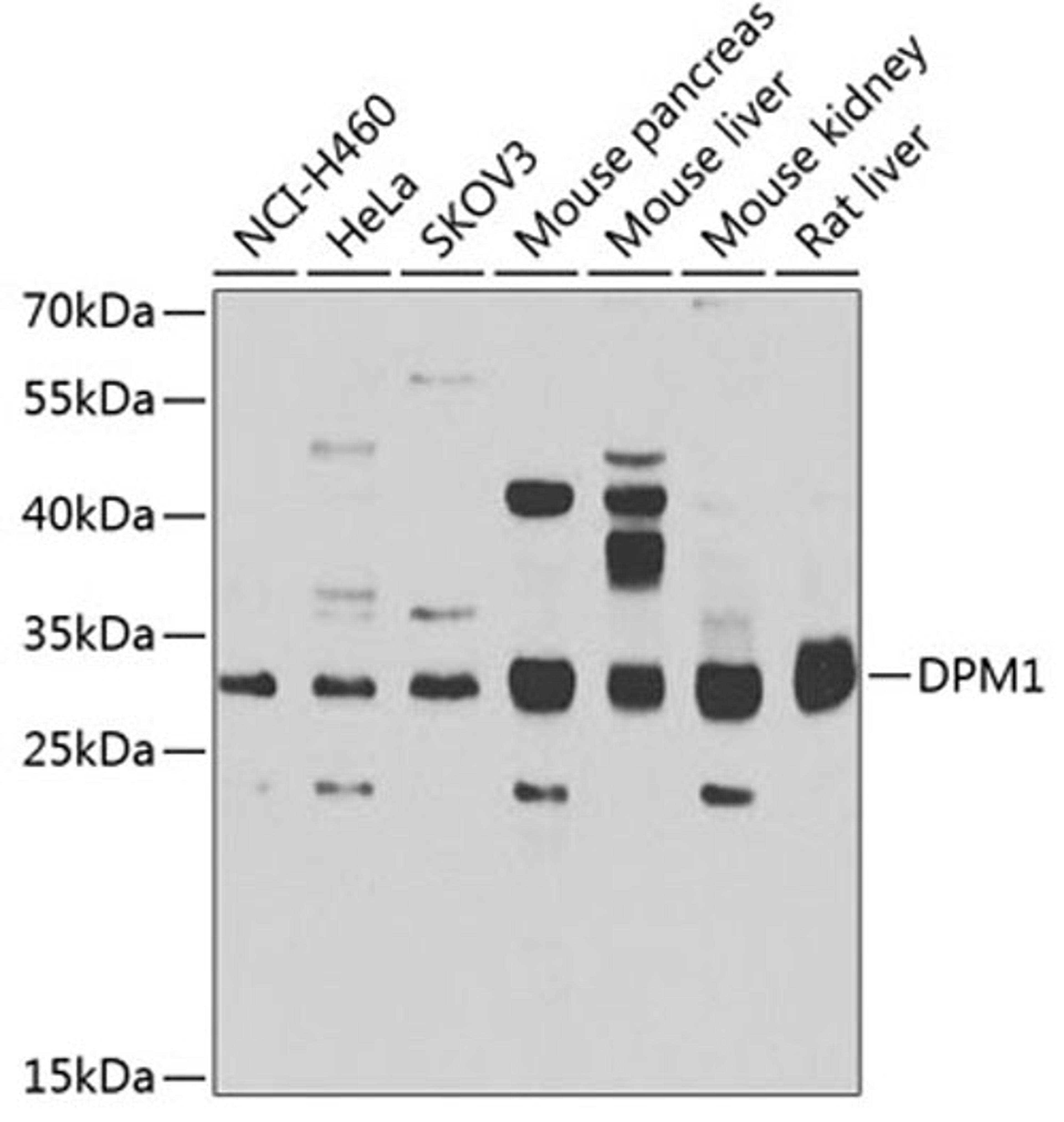 Western blot - DPM1 antibody (A7757)