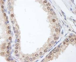 Detection of human FKBP4/FKBP52 by immunohistochemistry.