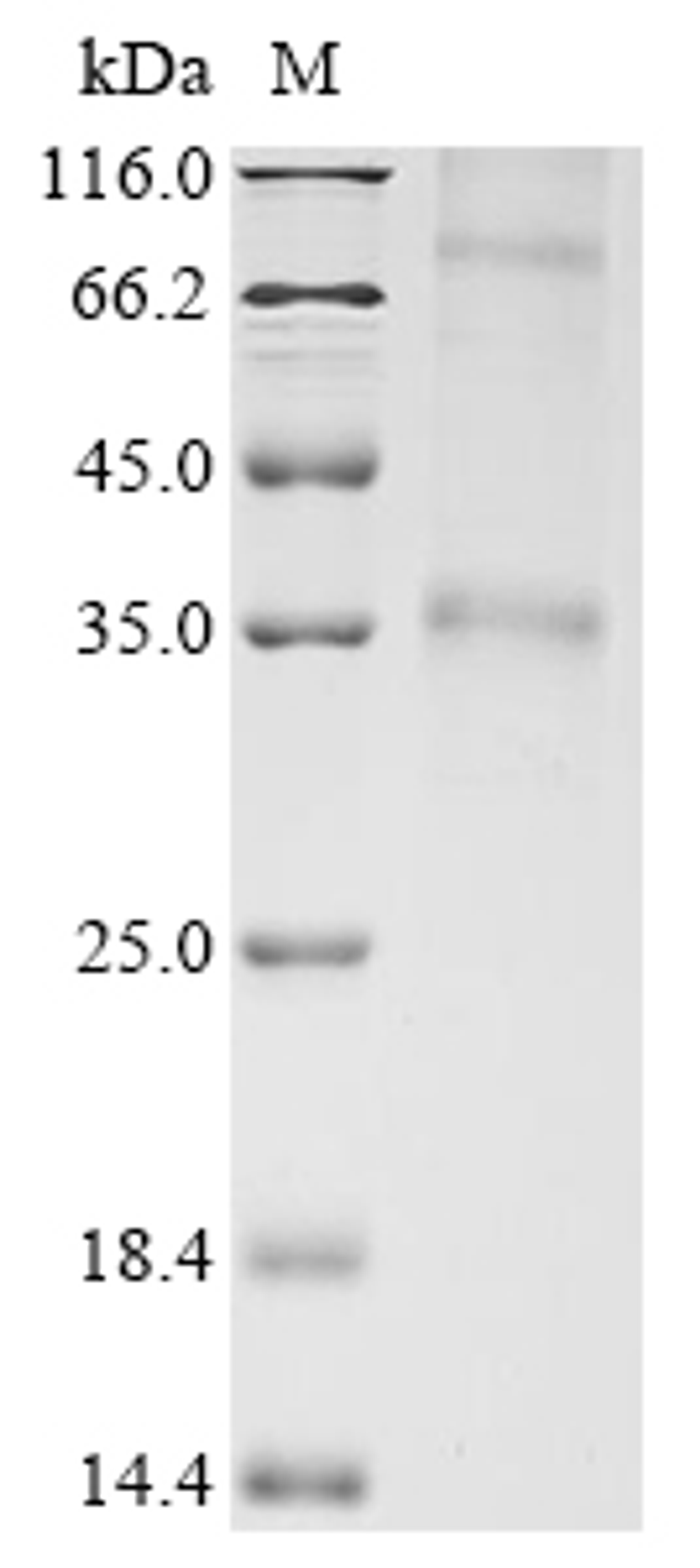 (Tris-Glycine gel) Discontinuous SDS-PAGE (reduced) with 5% enrichment gel and 15% separation gel.
