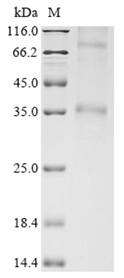 (Tris-Glycine gel) Discontinuous SDS-PAGE (reduced) with 5% enrichment gel and 15% separation gel.