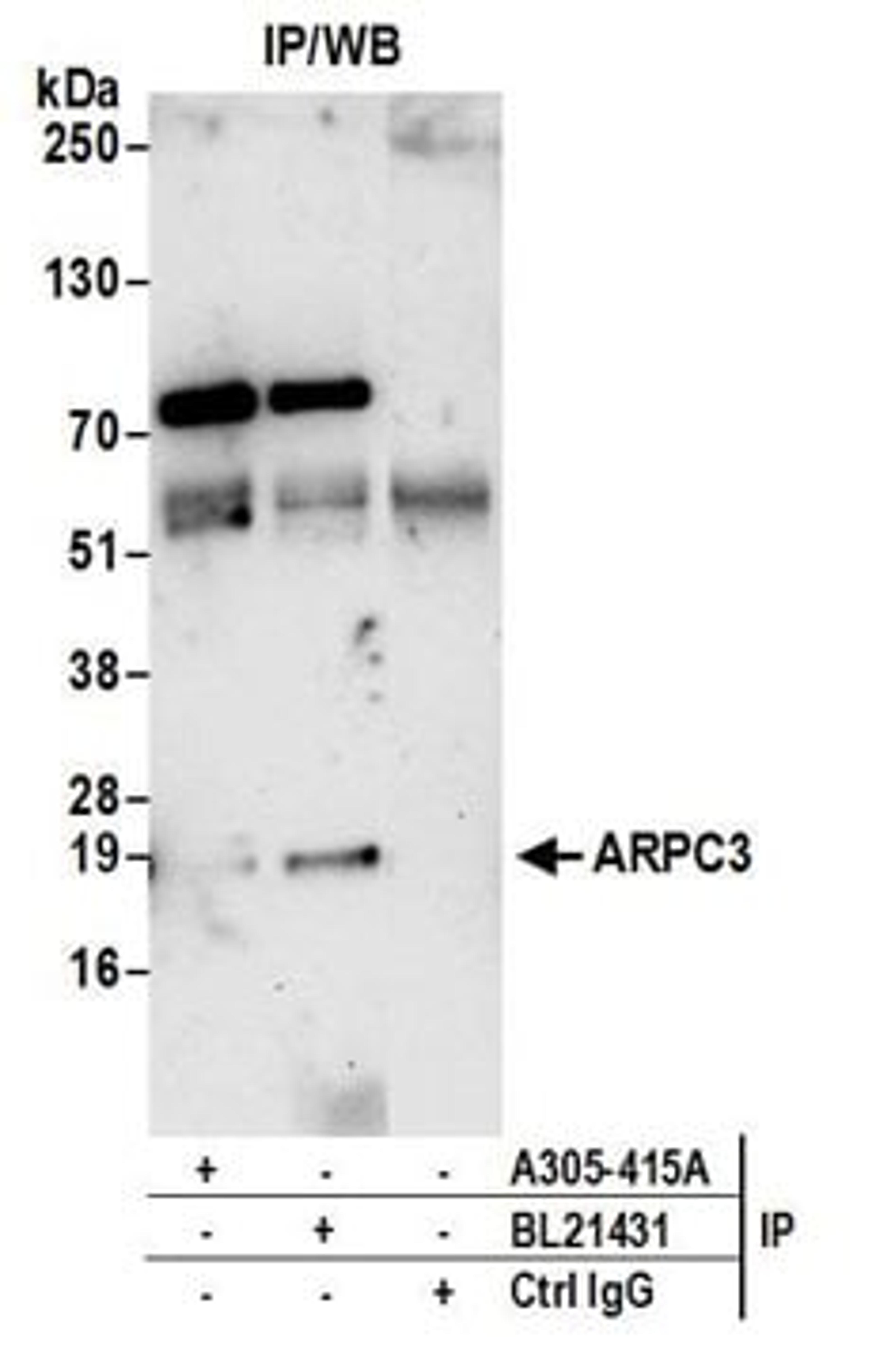 Detection of human ARPC3 by western blot of immunoprecipitates.