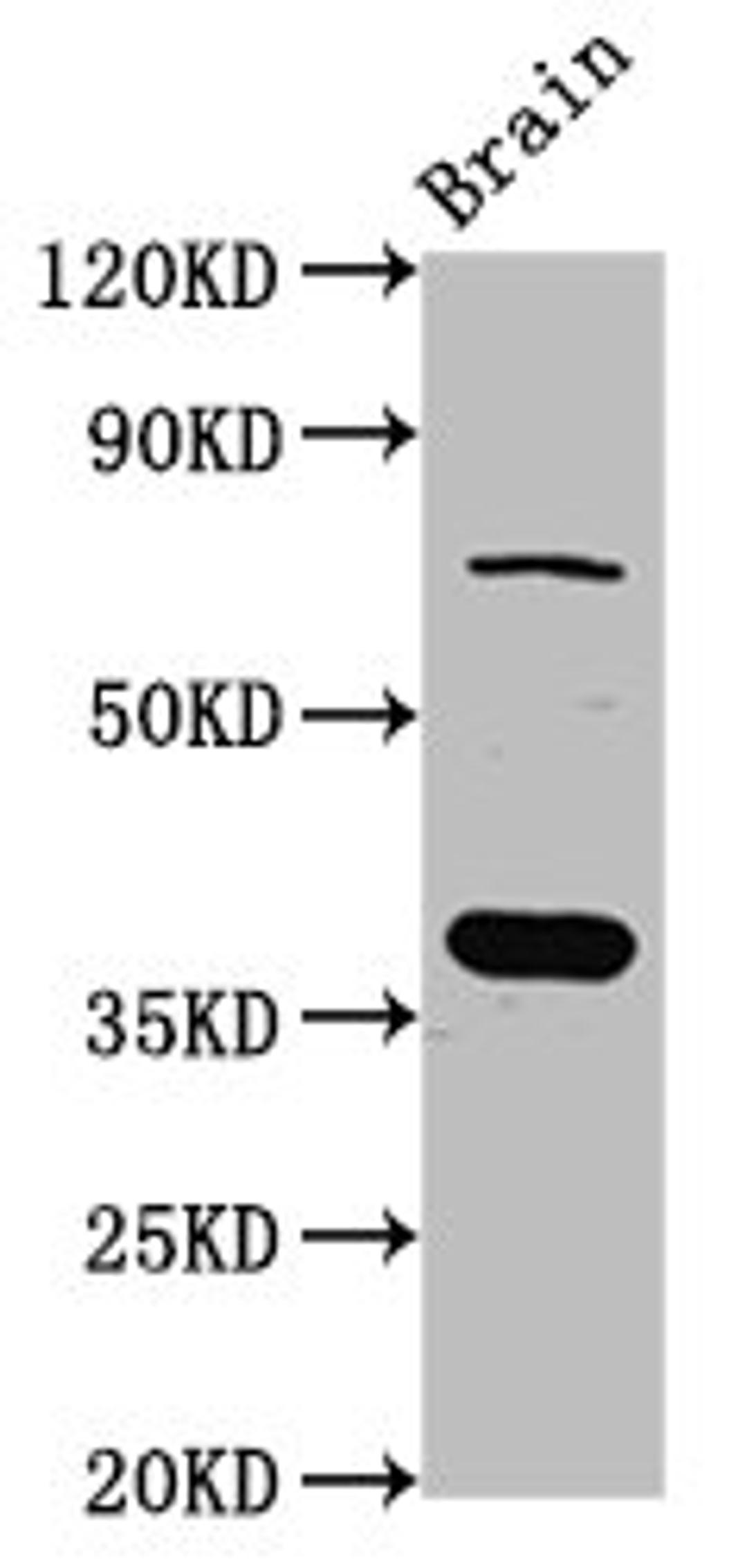 Western Blot. Positive WB detected in: Rat brain tissue. All lanes: SCAMP1 antibody at 4ug/ml. Secondary. Goat polyclonal to rabbit IgG at 1/50000 dilution. Predicted band size: 38, 19 kDa. Observed band size: 38 kDa.