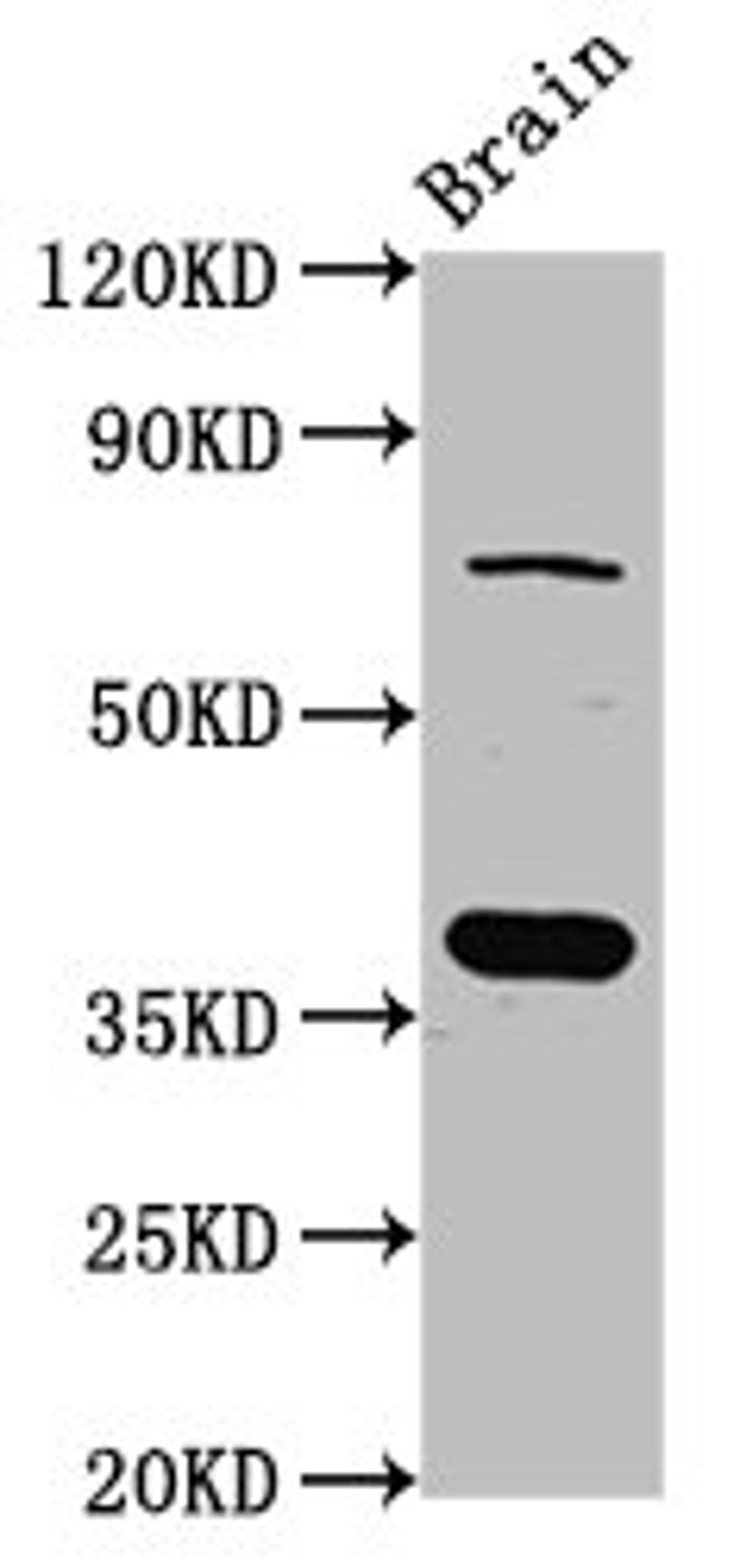 Western Blot. Positive WB detected in: Rat brain tissue. All lanes: SCAMP1 antibody at 4ug/ml. Secondary. Goat polyclonal to rabbit IgG at 1/50000 dilution. Predicted band size: 38, 19 kDa. Observed band size: 38 kDa.