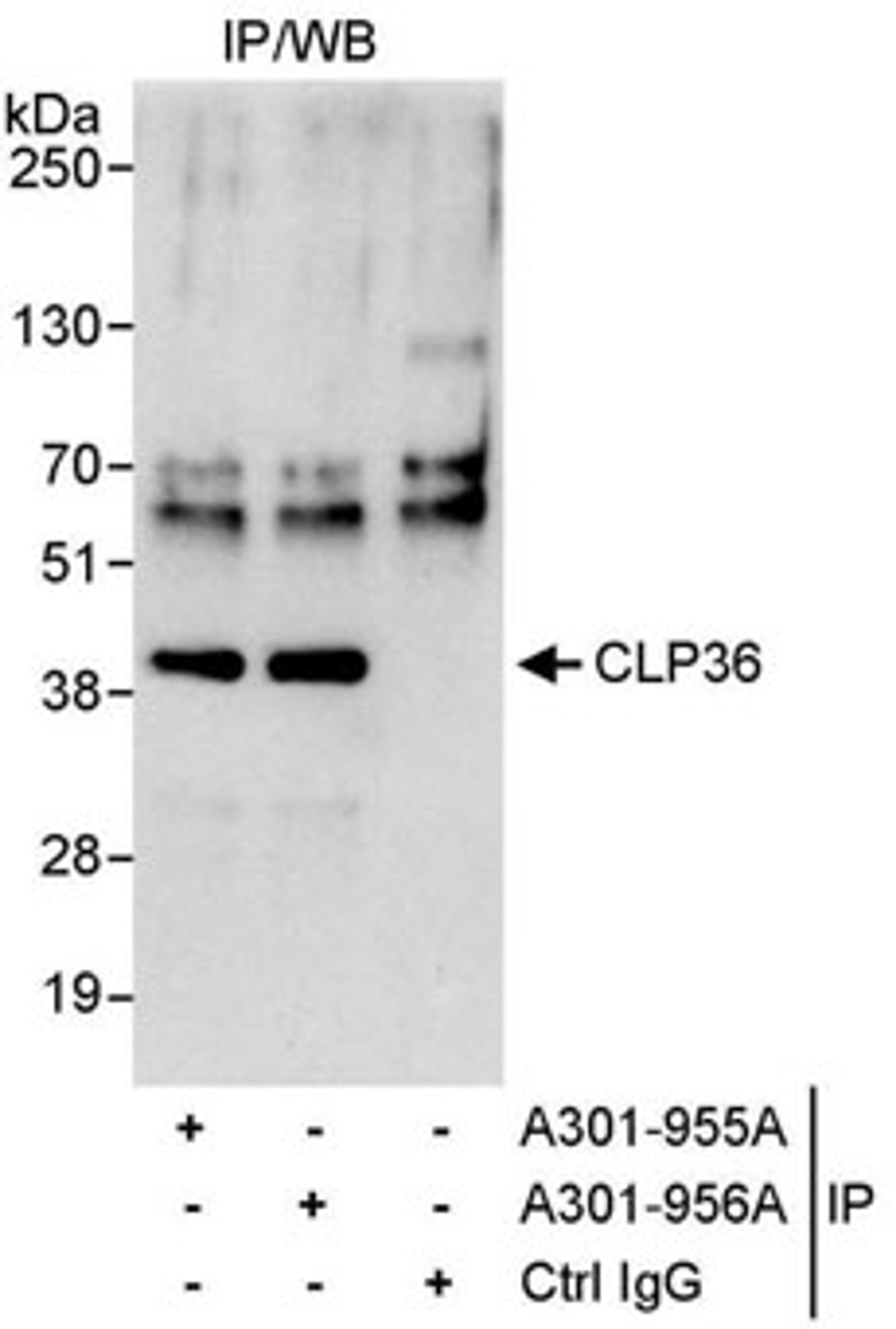 Detection of human CLP36 by western blot of immunoprecipitates.