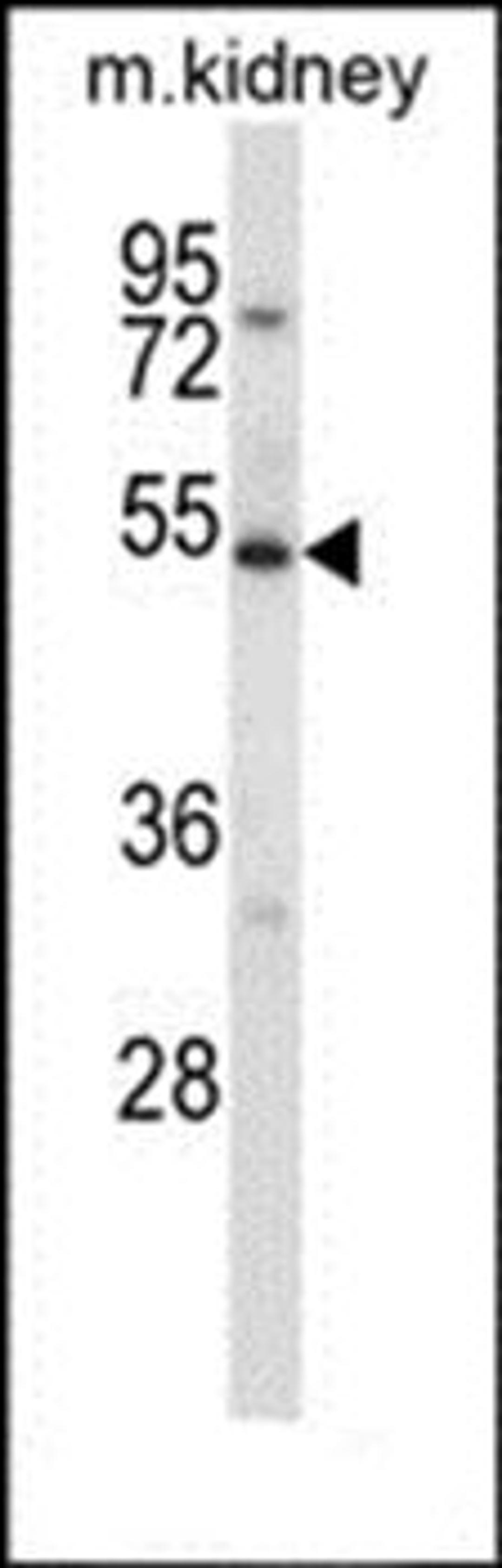 Western blot analysis of mouse kidney tissue lysates (35ug/lane)using ULK3 antibody (primary antibody dilution at: 1:1000)