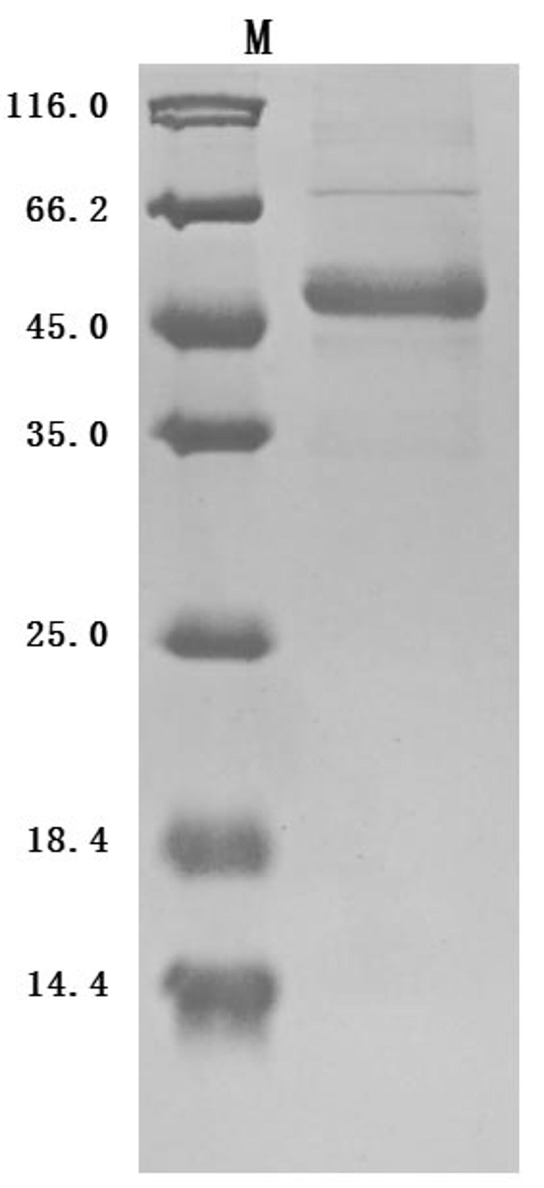 (Tris-Glycine gel) Discontinuous SDS-PAGE (reduced) with 5% enrichment gel and 15% separation gel.
