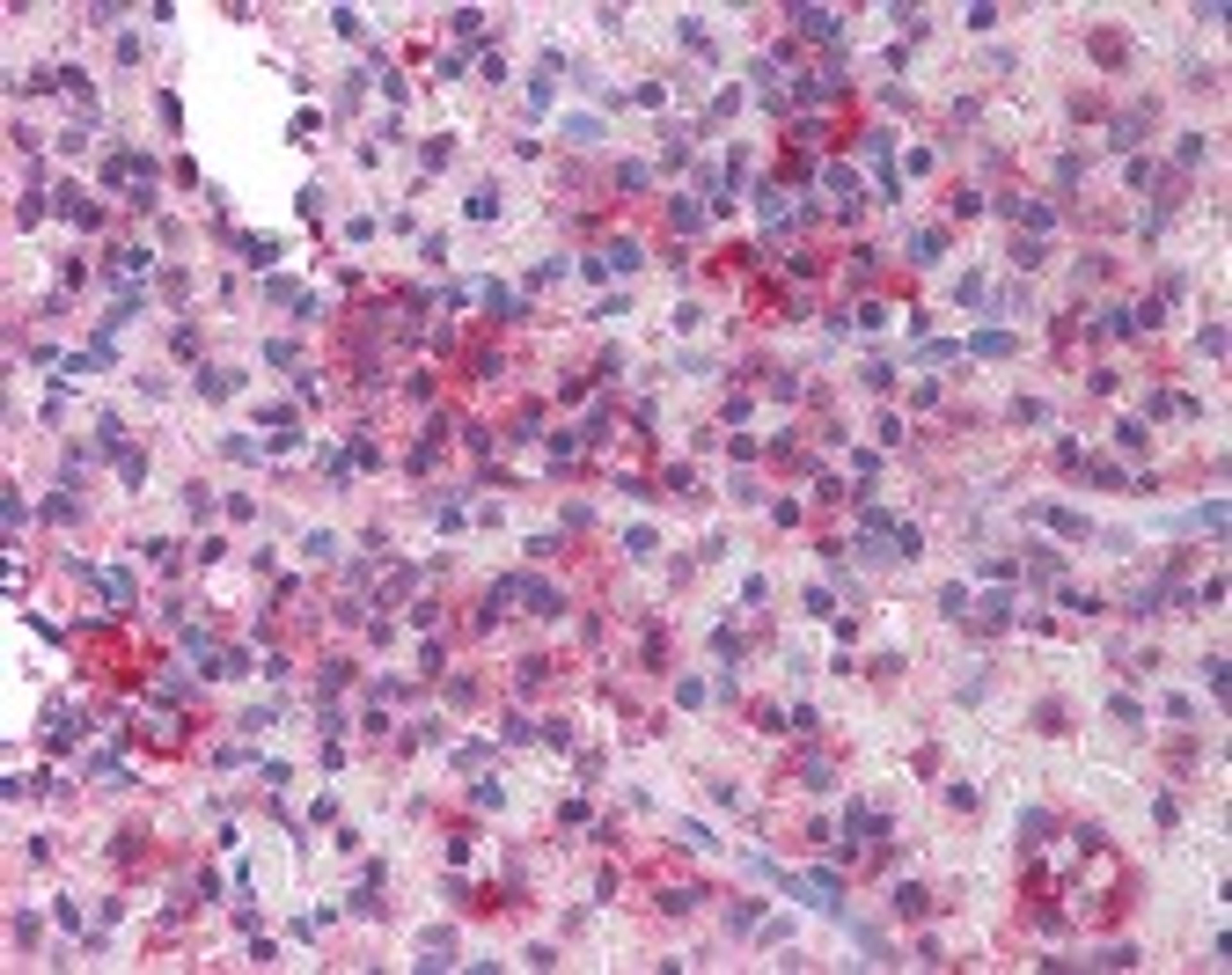 Immunohistochemistry staining of MLL in spleen tissue using MLL Antibody.