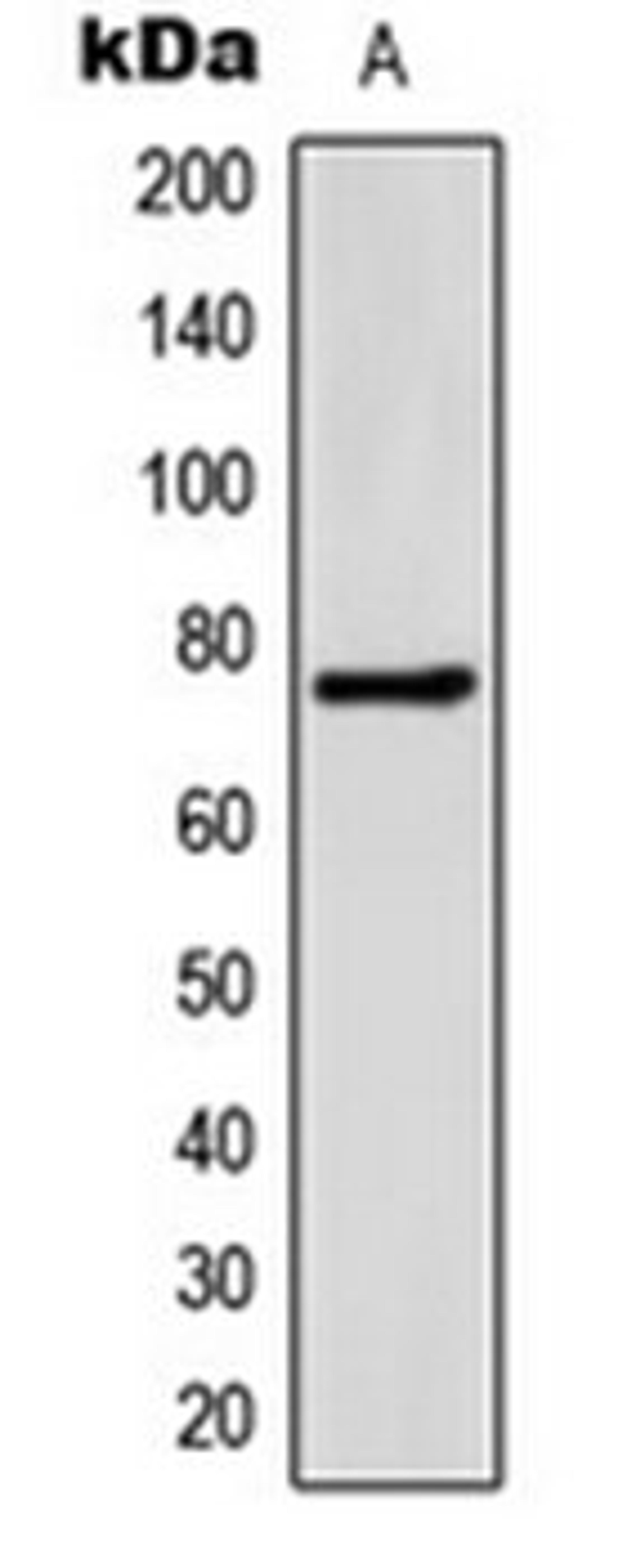 Western blot analysis of HeLa (Lane 1) whole cell lysates using FATP5 antibody