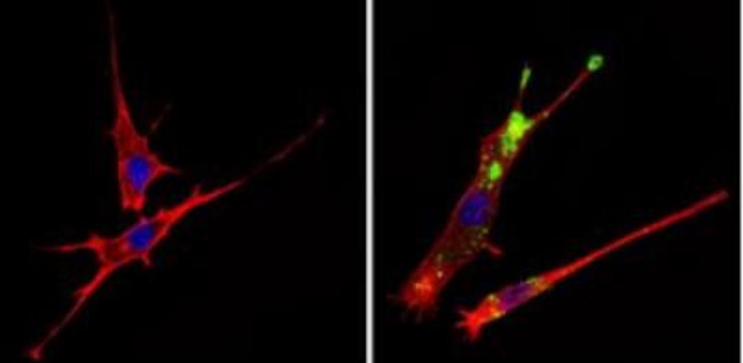 Immunocytochemistry/Immunofluorescence: c-Abl Antibody (8E9) [NBP2-49695] - taining in the cytoplasm of NIH-3T3 cells (right) compared to a negative control without primary antibody (left). Formalin-fixed cells were permeabilized with 0.1% Triton X-100 in TBS for 5-10 minutes and blocked with 3% BSA-PBS for 30 minutes at room temperature. Cells were probed with a c-Abl monoclonal antibody in 3% BSA-PBS at a dilution of 1:50 and incubated overnight at 4C in a humidified chamber. Cells were washed with PBST and incubated with a DyLight-conjugated secondary antibody in PBS at room temperature in the dark. F-actin (red) was stained with a fluorescent red phalloidin and nuclei (blue) were stained with Hoechst or DAPI. Images were taken at a magnification of 60x.