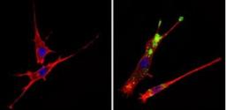 Immunocytochemistry/Immunofluorescence: c-Abl Antibody (8E9) [NBP2-49695] - taining in the cytoplasm of NIH-3T3 cells (right) compared to a negative control without primary antibody (left). Formalin-fixed cells were permeabilized with 0.1% Triton X-100 in TBS for 5-10 minutes and blocked with 3% BSA-PBS for 30 minutes at room temperature. Cells were probed with a c-Abl monoclonal antibody in 3% BSA-PBS at a dilution of 1:50 and incubated overnight at 4C in a humidified chamber. Cells were washed with PBST and incubated with a DyLight-conjugated secondary antibody in PBS at room temperature in the dark. F-actin (red) was stained with a fluorescent red phalloidin and nuclei (blue) were stained with Hoechst or DAPI. Images were taken at a magnification of 60x.