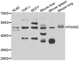 Western blot analysis of extracts of various cell lines using FOXN2 antibody