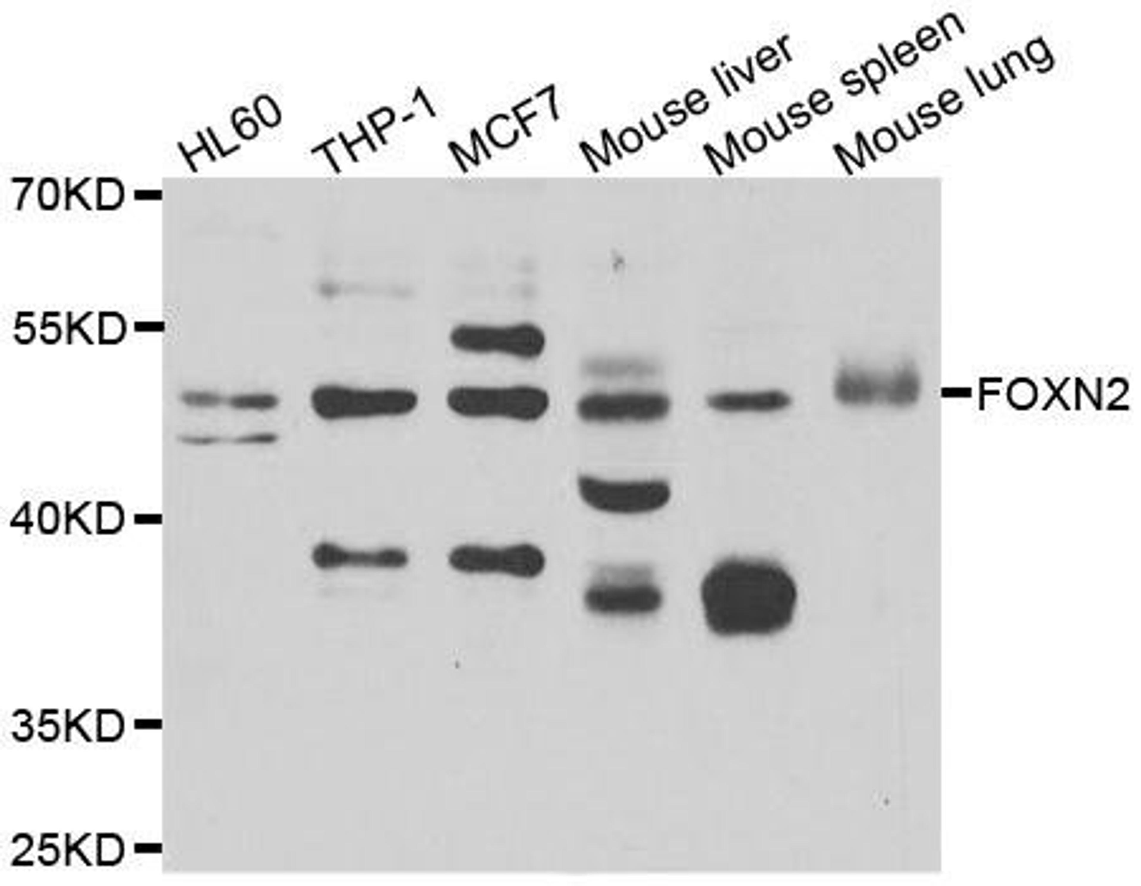 Western blot analysis of extracts of various cell lines using FOXN2 antibody