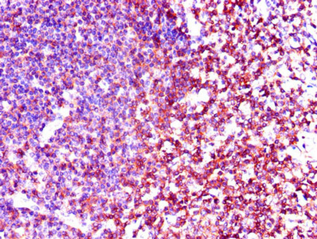 Immunohistochemistry of paraffin-embedded human tonsil tissue using CSB-PA012806LA01HU at dilution of 1:100