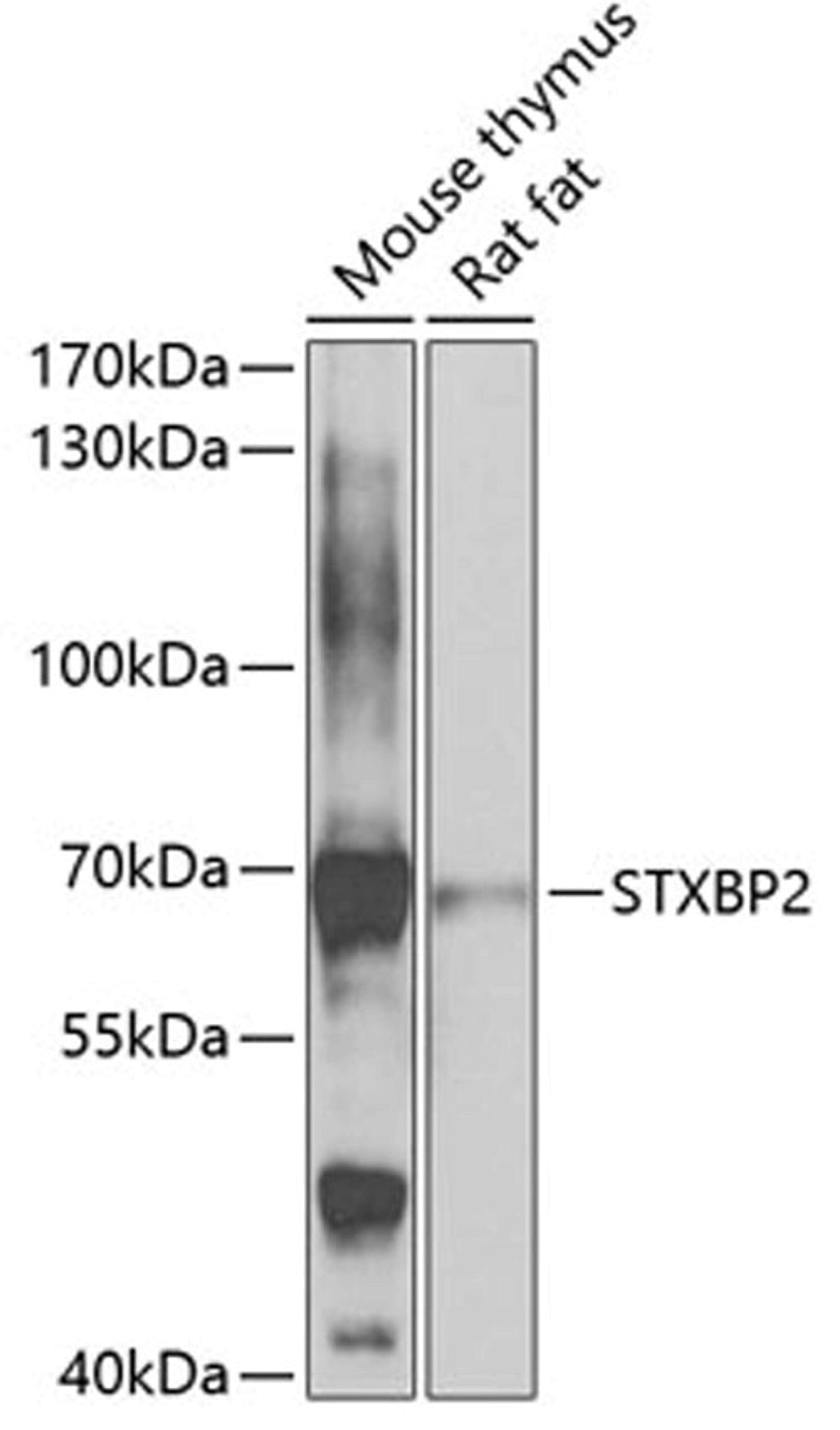 Western blot - STXBP2 antibody (A7735)