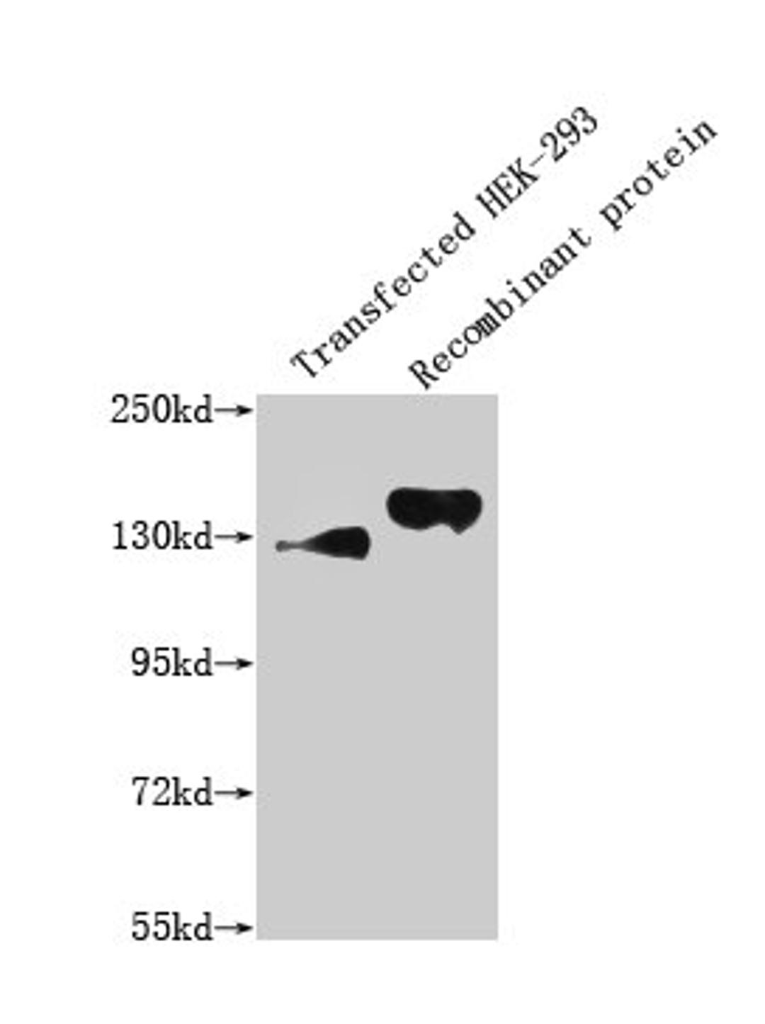 Western Blot. Positive WB detected in: 293T whole cell lysate transfected with SEMA4D; Recombinant proteins with SEMA4D. All lanes: SEMA4D antibody at 1:1000. Secondary. Goat polyclonal to mouse IgG at 1/50000 dilution. Predicted band size: 130, 150 KDa. Observed band size: 130, 150 KDa. Exposure time:5min