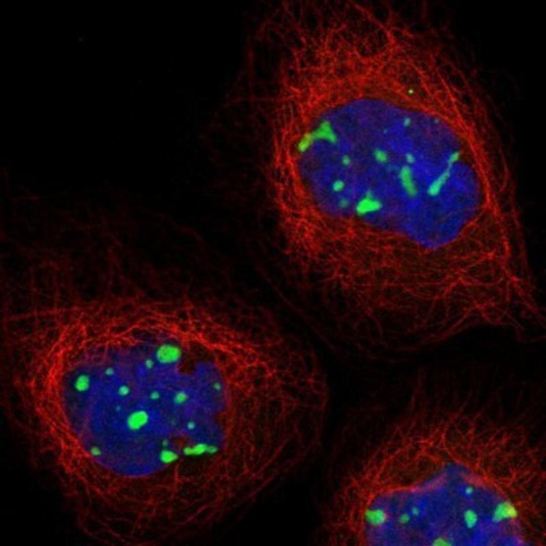 Immunocytochemistry/Immunofluorescence: MPHOSPH10 Antibody [NBP1-84341] - Staining of human cell line A-431 shows positivity in nucleoli.