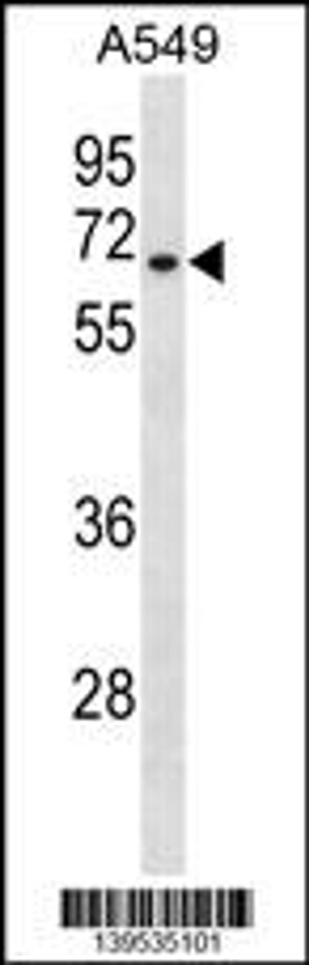 Western blot analysis in A549 cell line lysates (35ug/lane).