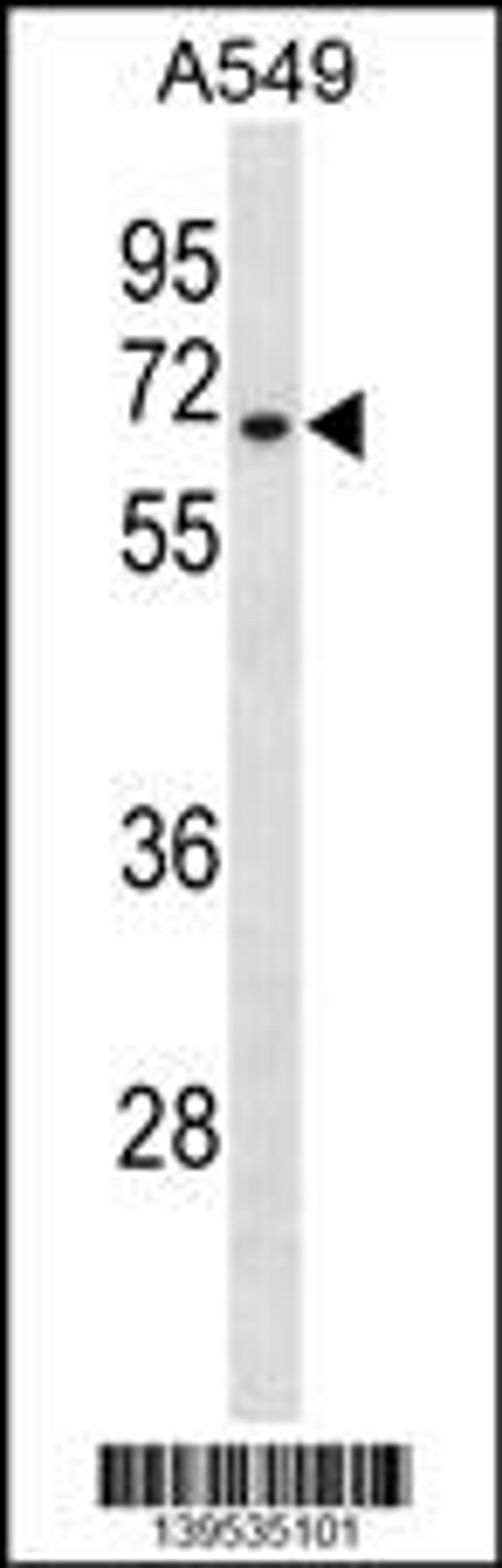 Western blot analysis in A549 cell line lysates (35ug/lane).