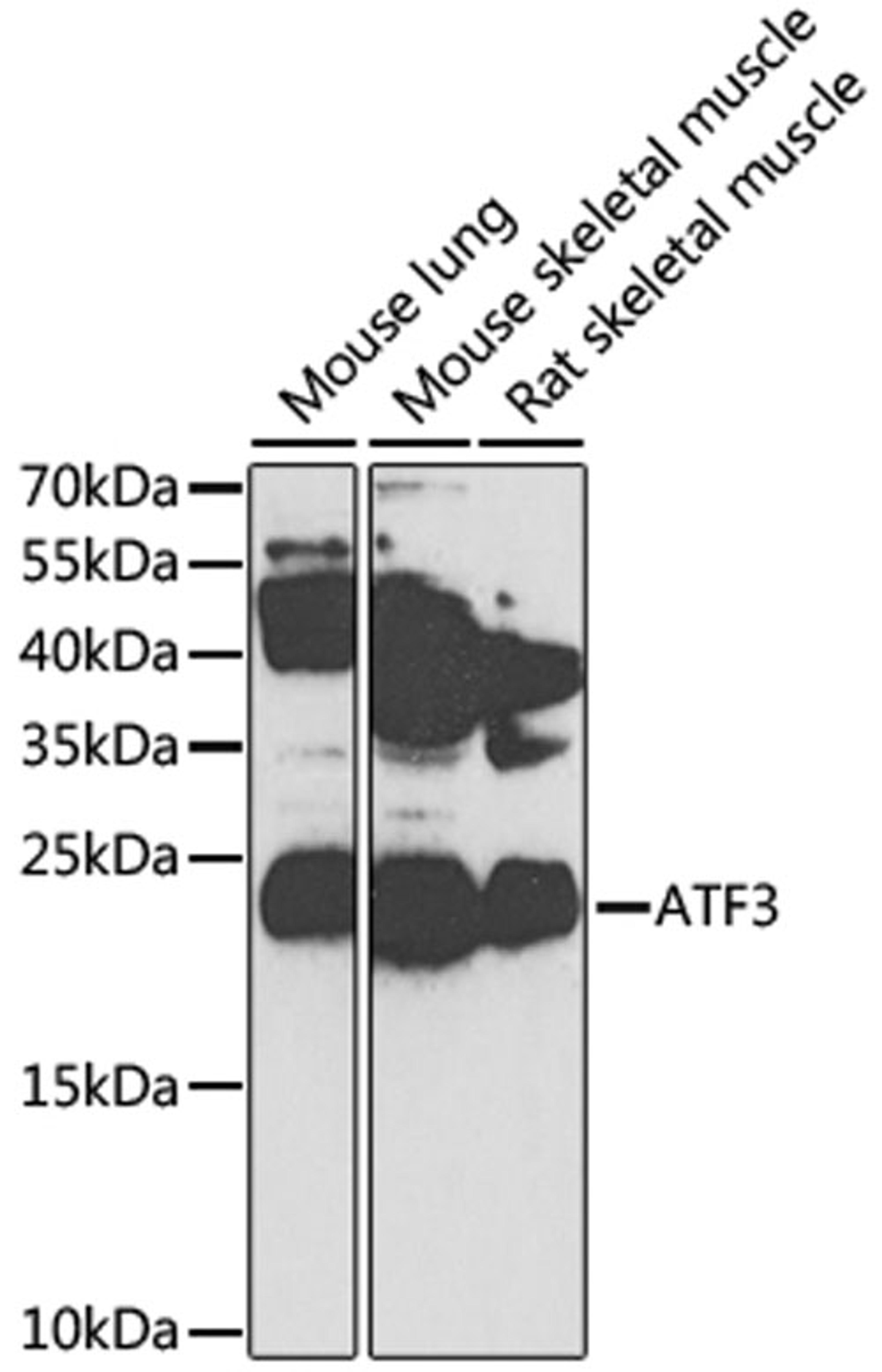 Western blot - ATF3 antibody (A1852)