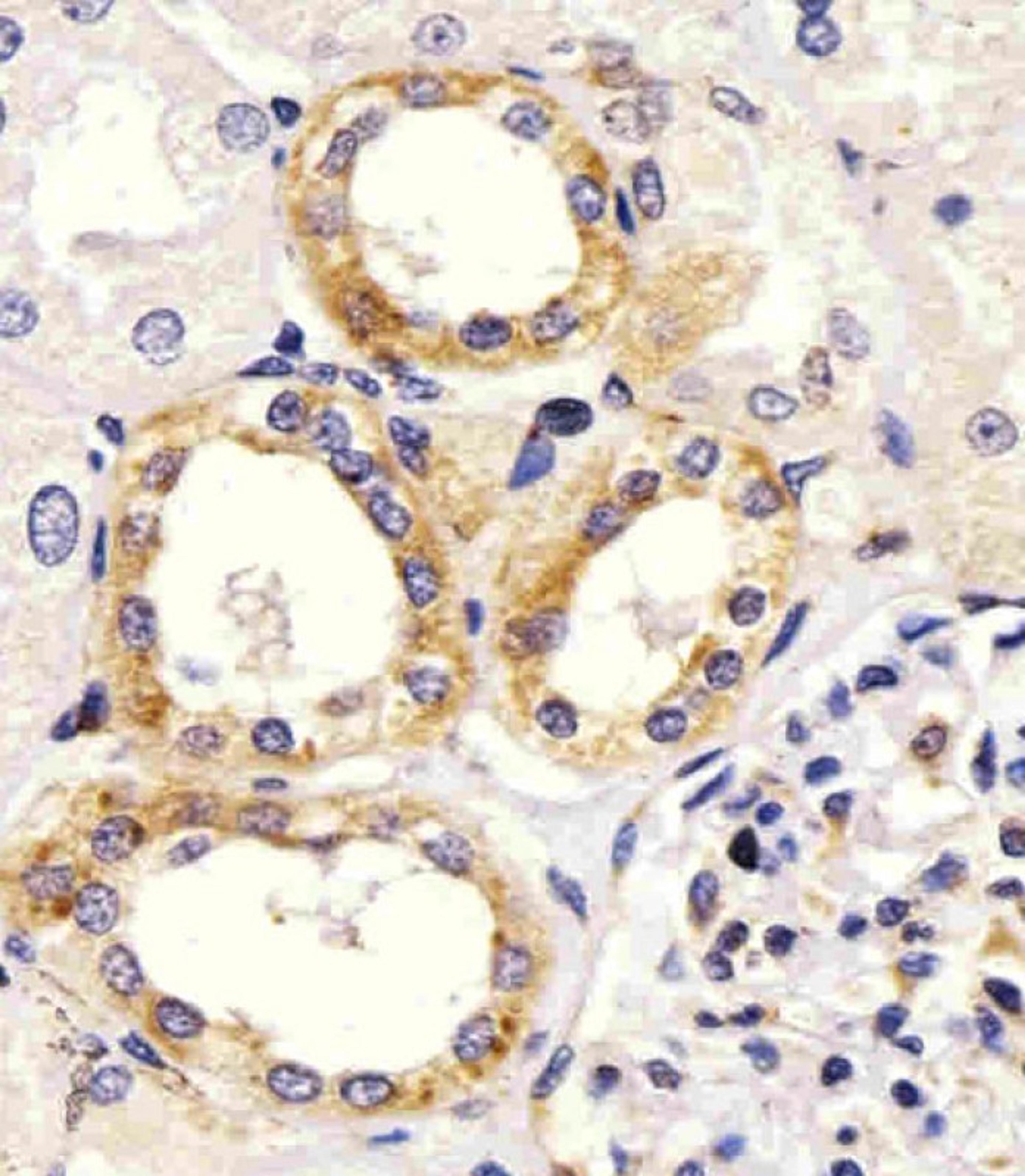 Antibody staining EGF in Human kidney tissue sections by Immunohistochemistry (IHC-P - paraformaldehyde-fixed, paraffin-embedded sections).