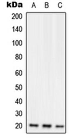 Western blot analysis of Jurkat (Lane 1), Raw264.7 (Lane 2), H9C2 (Lane 3) whole cell lysates using RGS10 antibody