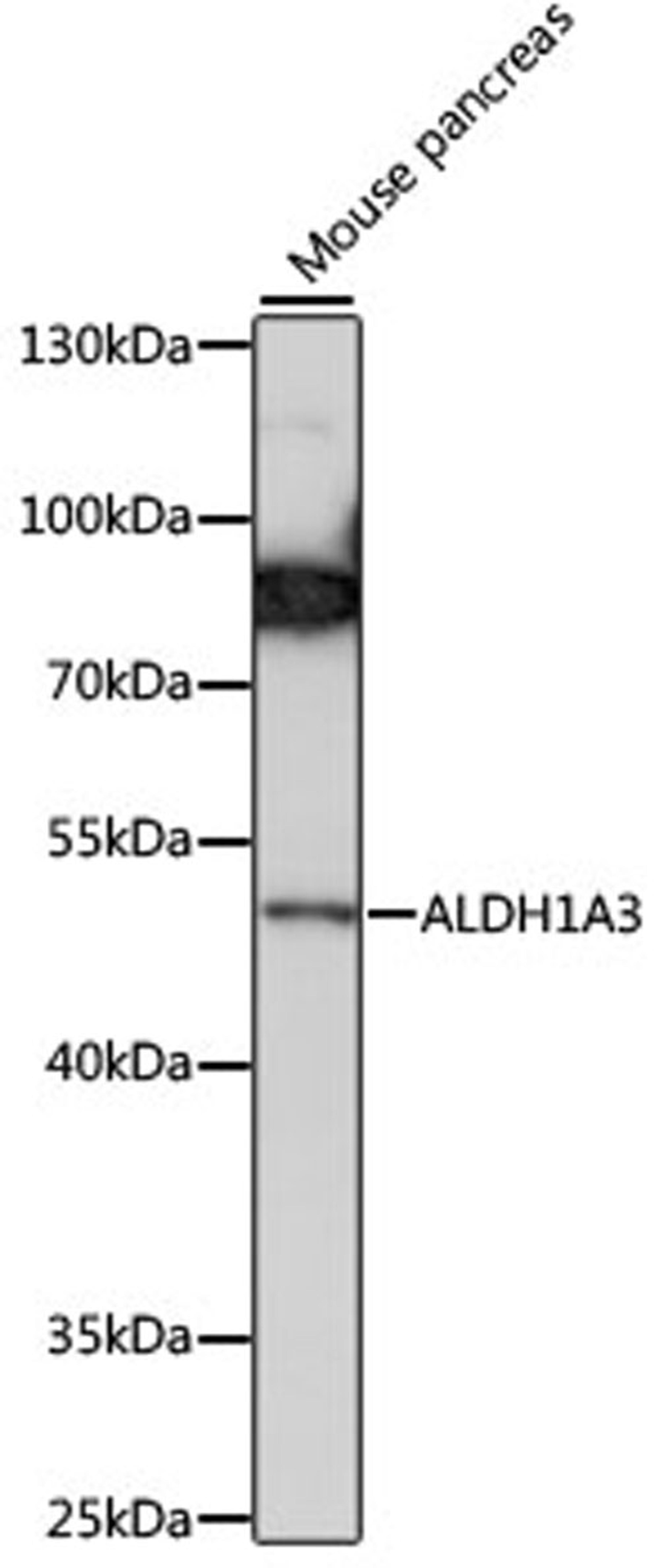 Western blot - ALDH1A3 antibody (A15230)