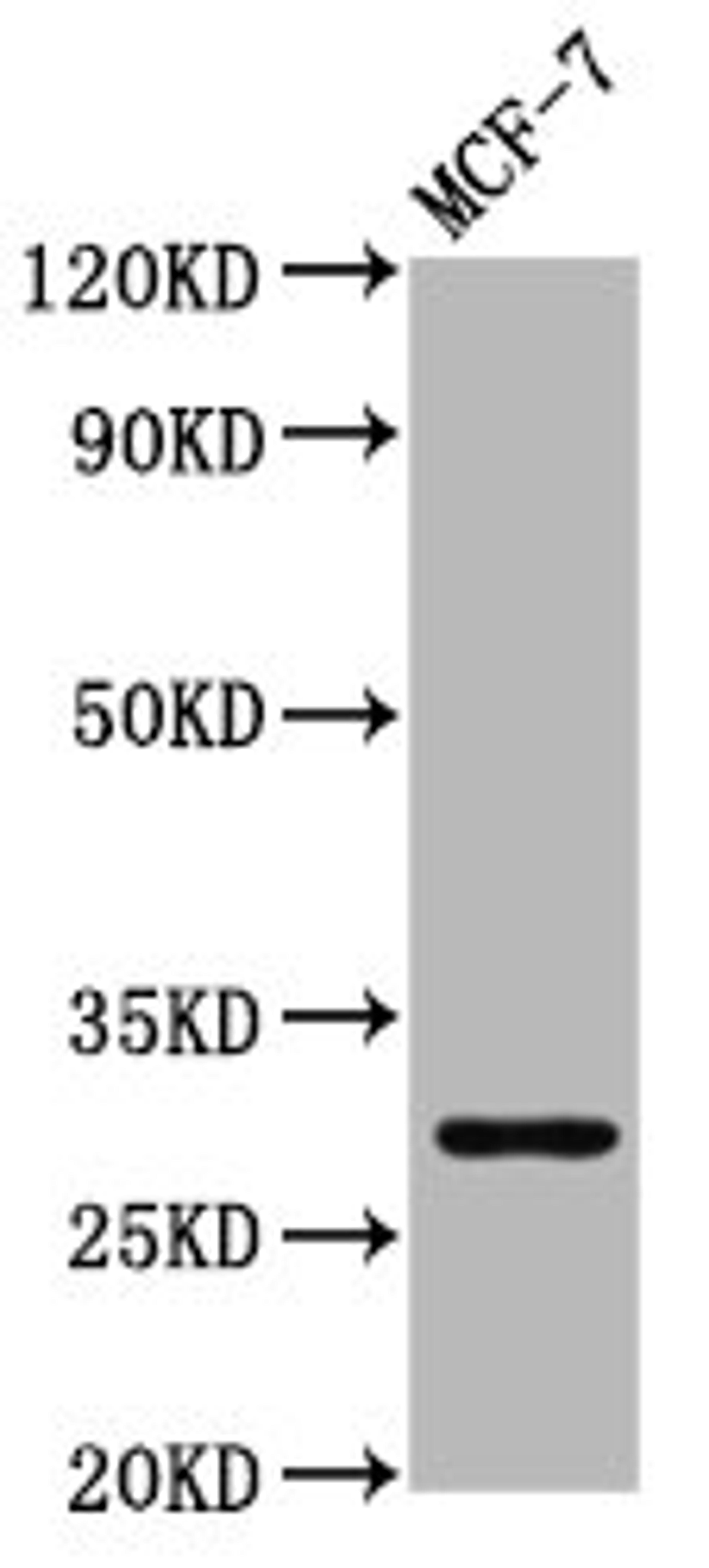 Western Blot. Positive WB detected in: MCF-7 whole cell lysate. All lanes: MYOZ2 antibody at 4.31µg/ml. Secondary. Goat polyclonal to rabbit IgG at 1/50000 dilution. Predicted band size: 30 kDa. Observed band size: 30 kDa