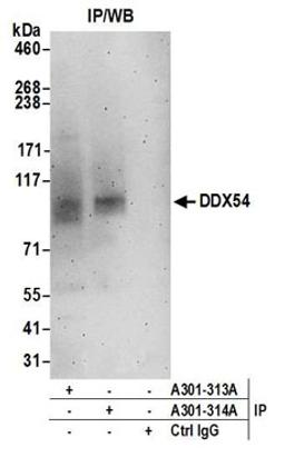 Detection of human DDX54 by western blot of immunoprecipitates.