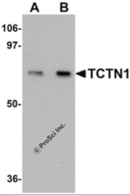 Western blot analysis of TCTN1 in mouse kidney tissue lysate with TCTN1 antibody at (A) 1 and (B) 2&#956;g/mL.