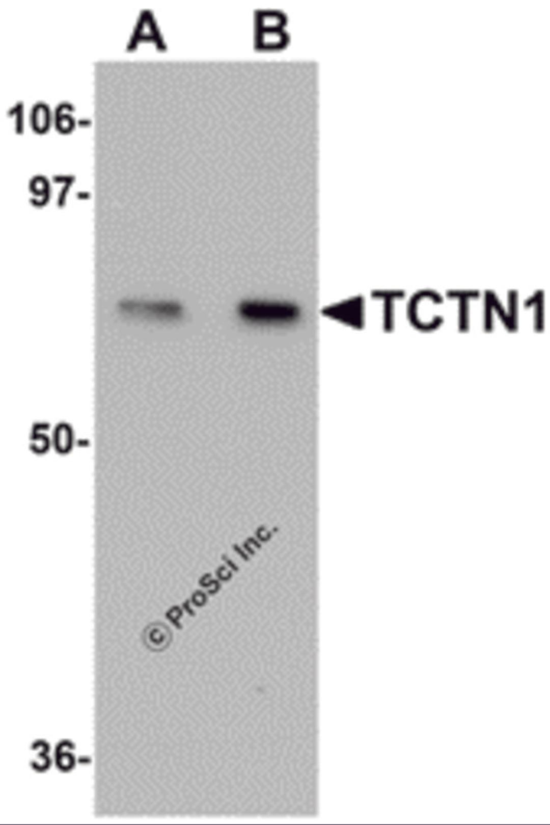 Western blot analysis of TCTN1 in mouse kidney tissue lysate with TCTN1 antibody at (A) 1 and (B) 2μg/mL.