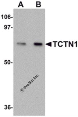 Western blot analysis of TCTN1 in mouse kidney tissue lysate with TCTN1 antibody at (A) 1 and (B) 2μg/mL.