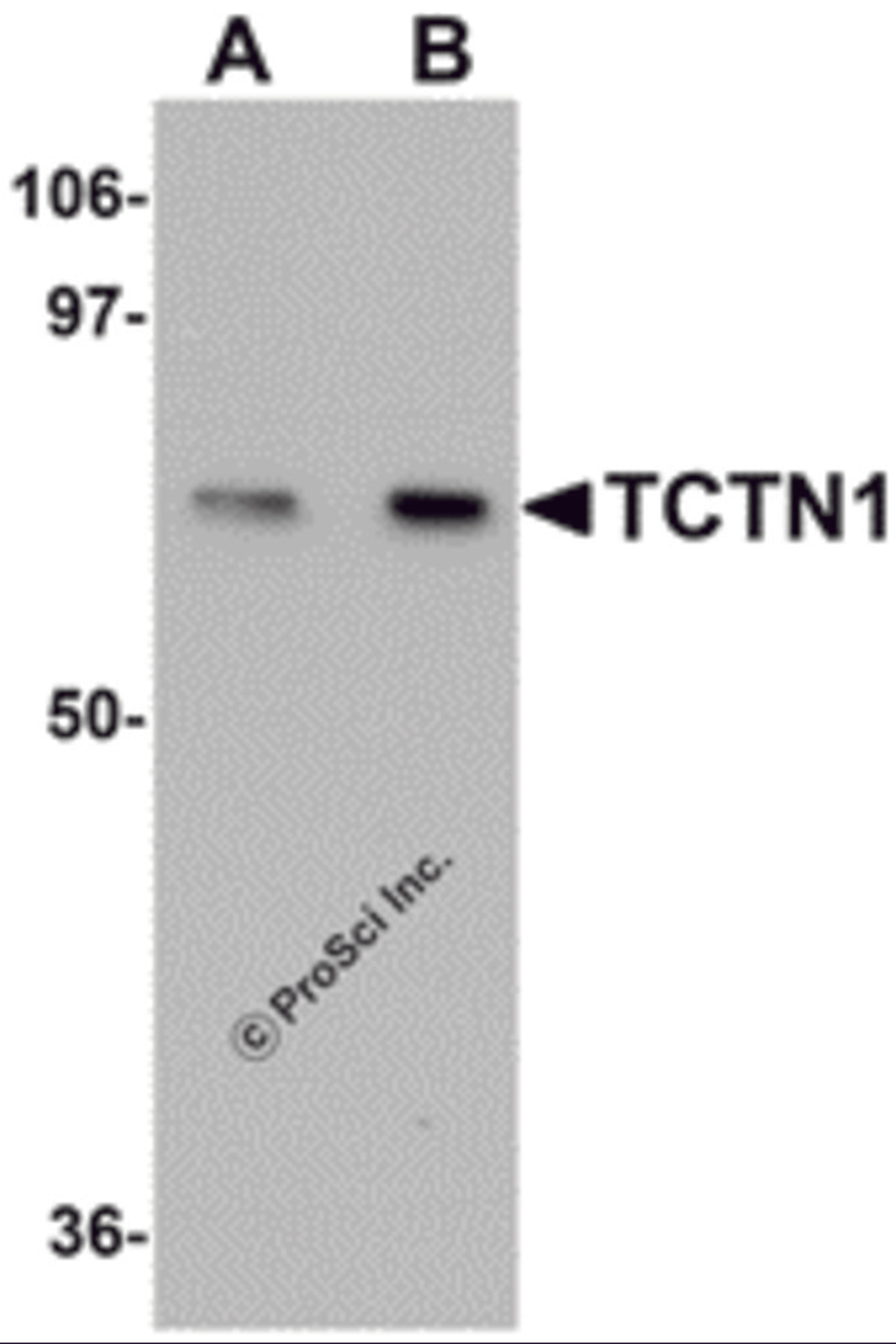Western blot analysis of TCTN1 in mouse kidney tissue lysate with TCTN1 antibody at (A) 1 and (B) 2μg/mL.