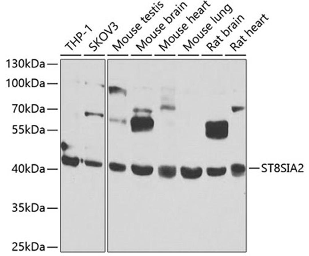 Western blot - ST8SIA2 antibody (A7748)