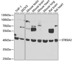 Western blot - ST8SIA2 antibody (A7748)