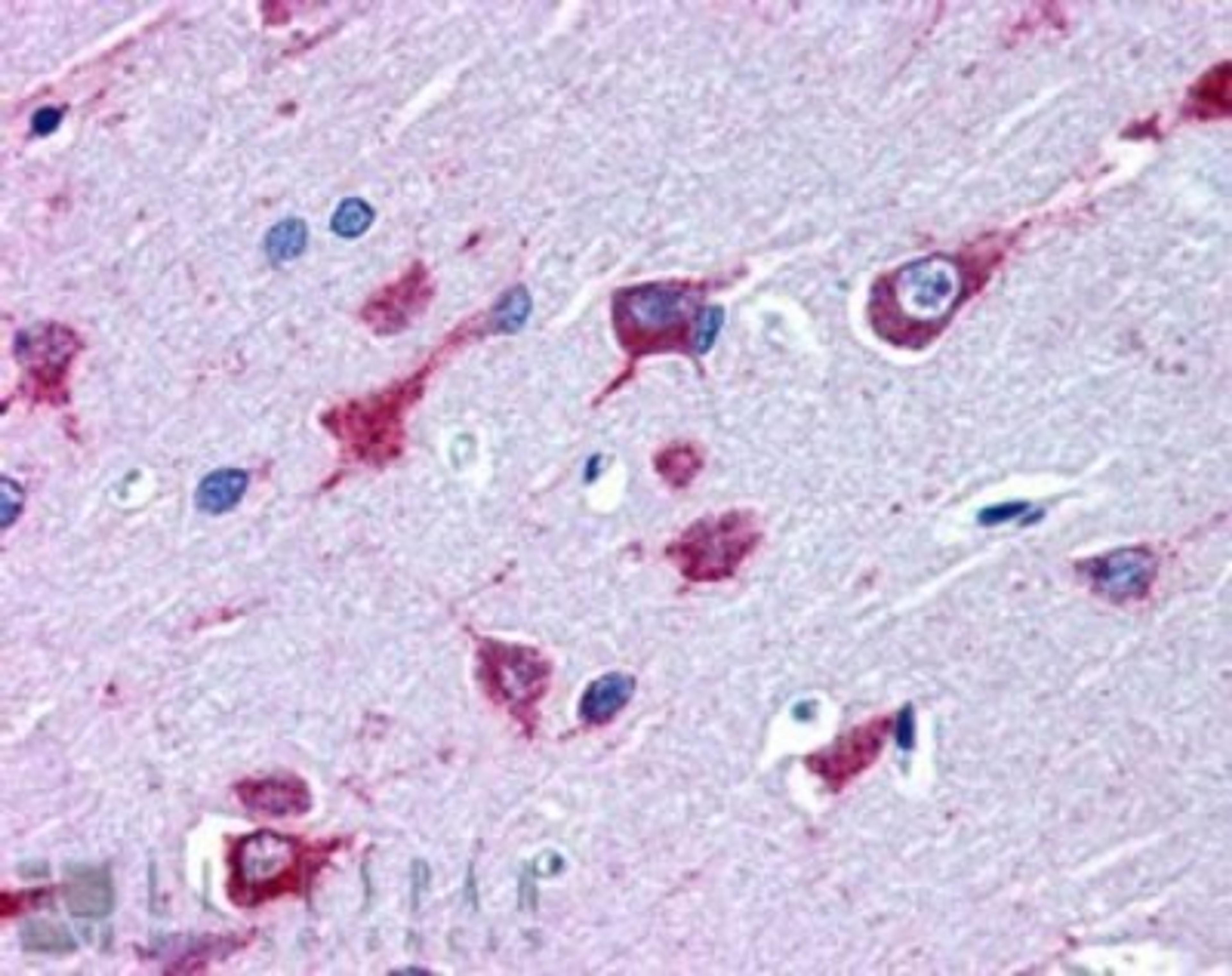 Immunohistochemistry: Als2 Antibody [NB100-885] - IHC staining of Als2 in paraffin embedded Human Cortex using NB100-885 at 3.8ug/ml. Steamed antigen retrieval with citrate buffer pH 6, AP-staining.