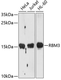 Western blot - RBM3 antibody (A5931)